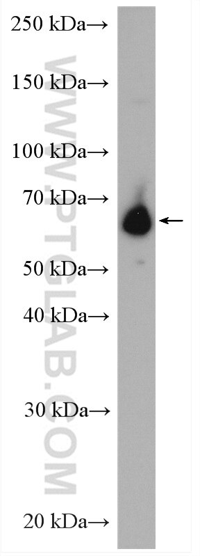 Western Blot (WB) analysis of Jurkat cells using NET1 Polyclonal antibody (28180-1-AP)