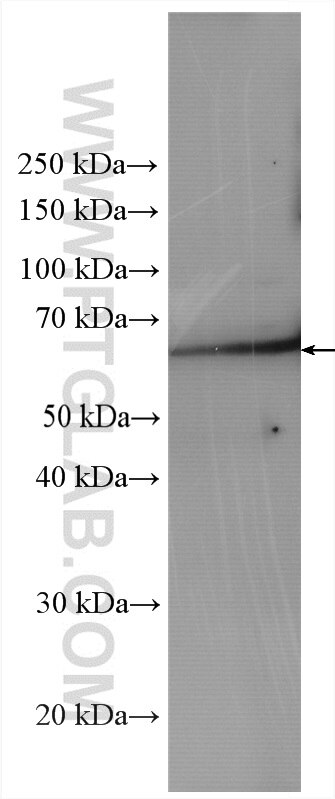 Western Blot (WB) analysis of mouse brain tissue using NET1 Polyclonal antibody (28180-1-AP)