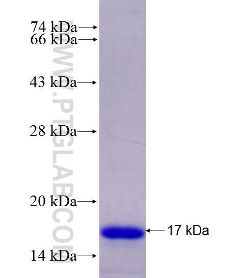 NET1 fusion protein Ag28151 SDS-PAGE