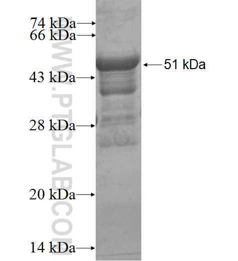 NET1 fusion protein Ag3636 SDS-PAGE