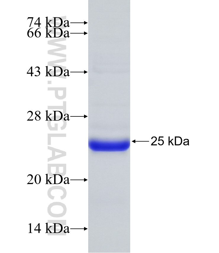 NETO1 fusion protein Ag32183 SDS-PAGE NETO1 fusion protein Ag32183 SDS-PAGE