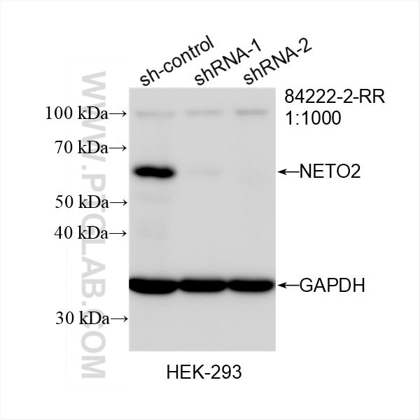 Western Blot (WB) analysis of HEK-293 cells using NETO2 Recombinant antibody (84222-2-RR)