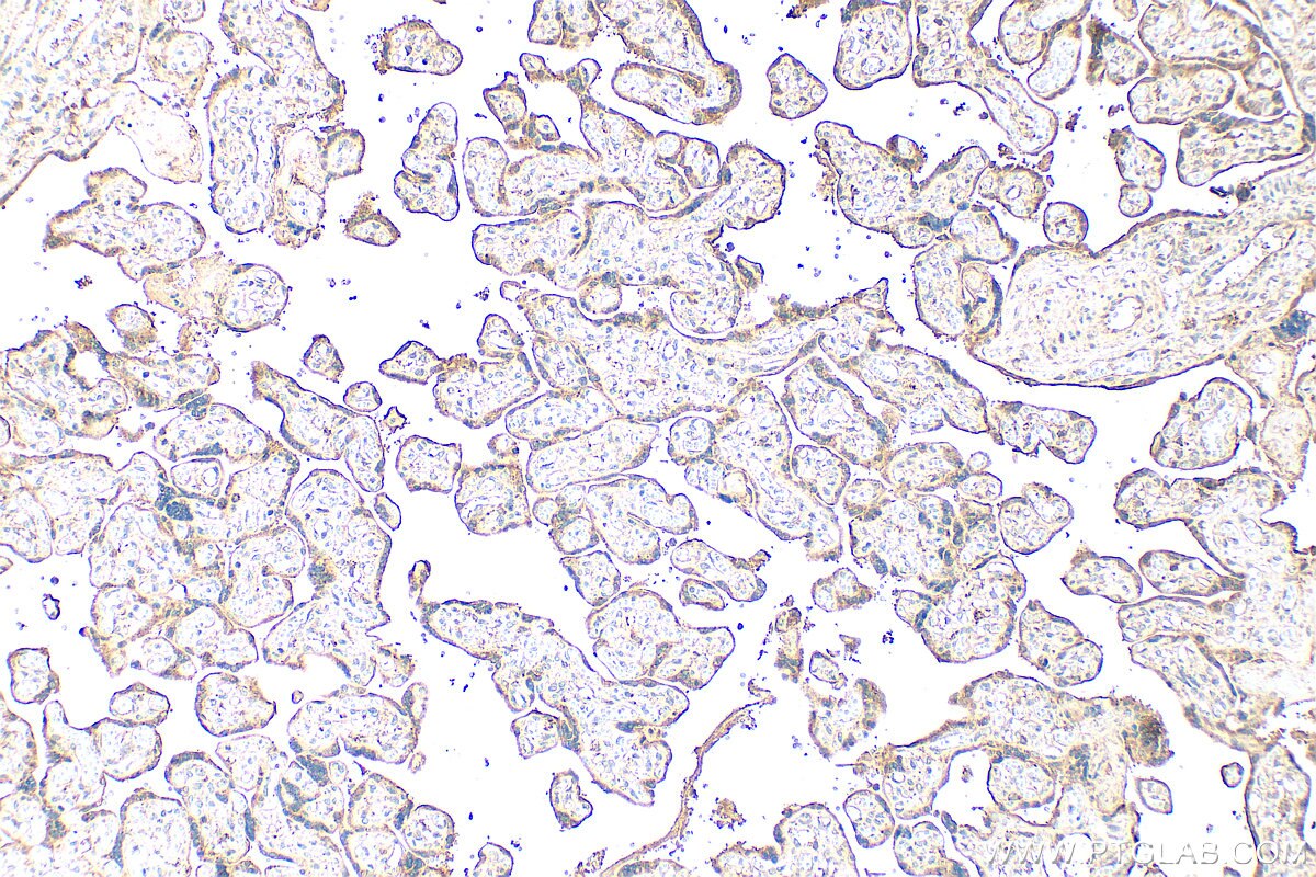 Immunohistochemistry (IHC) staining of human placenta tissue using NEU1 Polyclonal antibody (28167-1-AP)