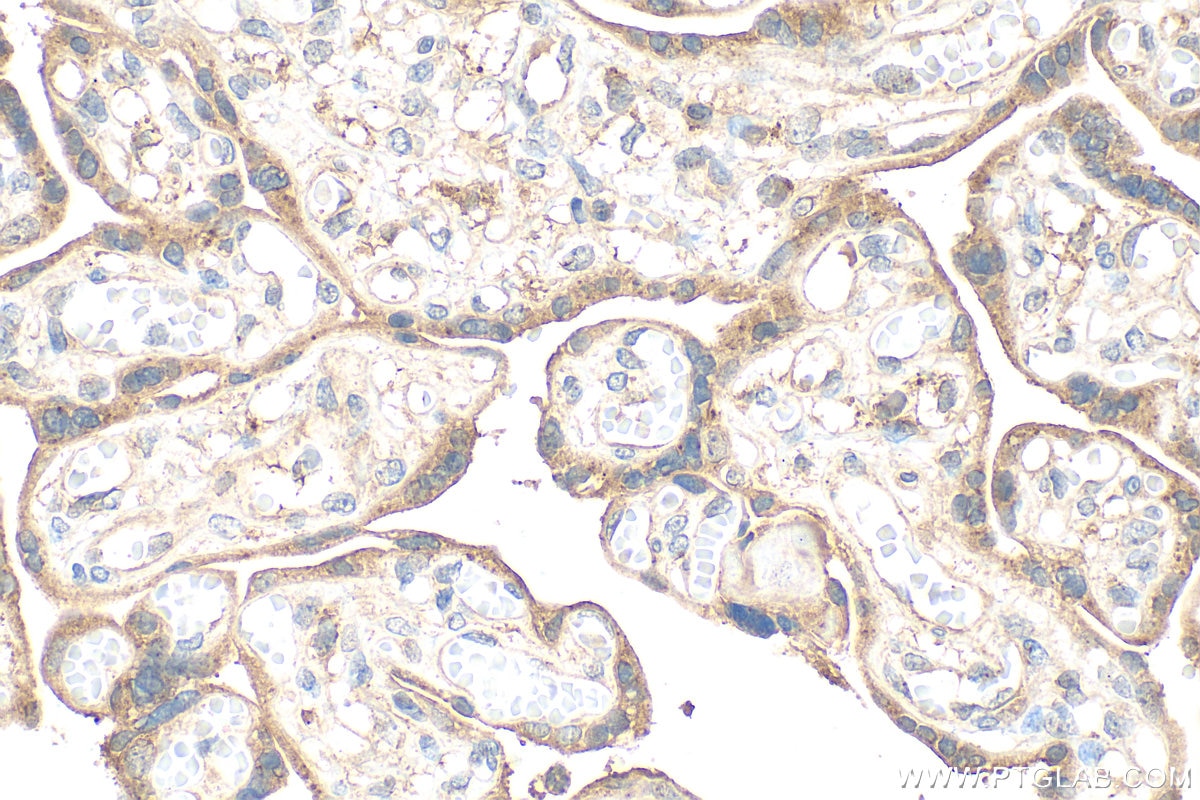 Immunohistochemistry (IHC) staining of human placenta tissue using NEU1 Polyclonal antibody (28167-1-AP)