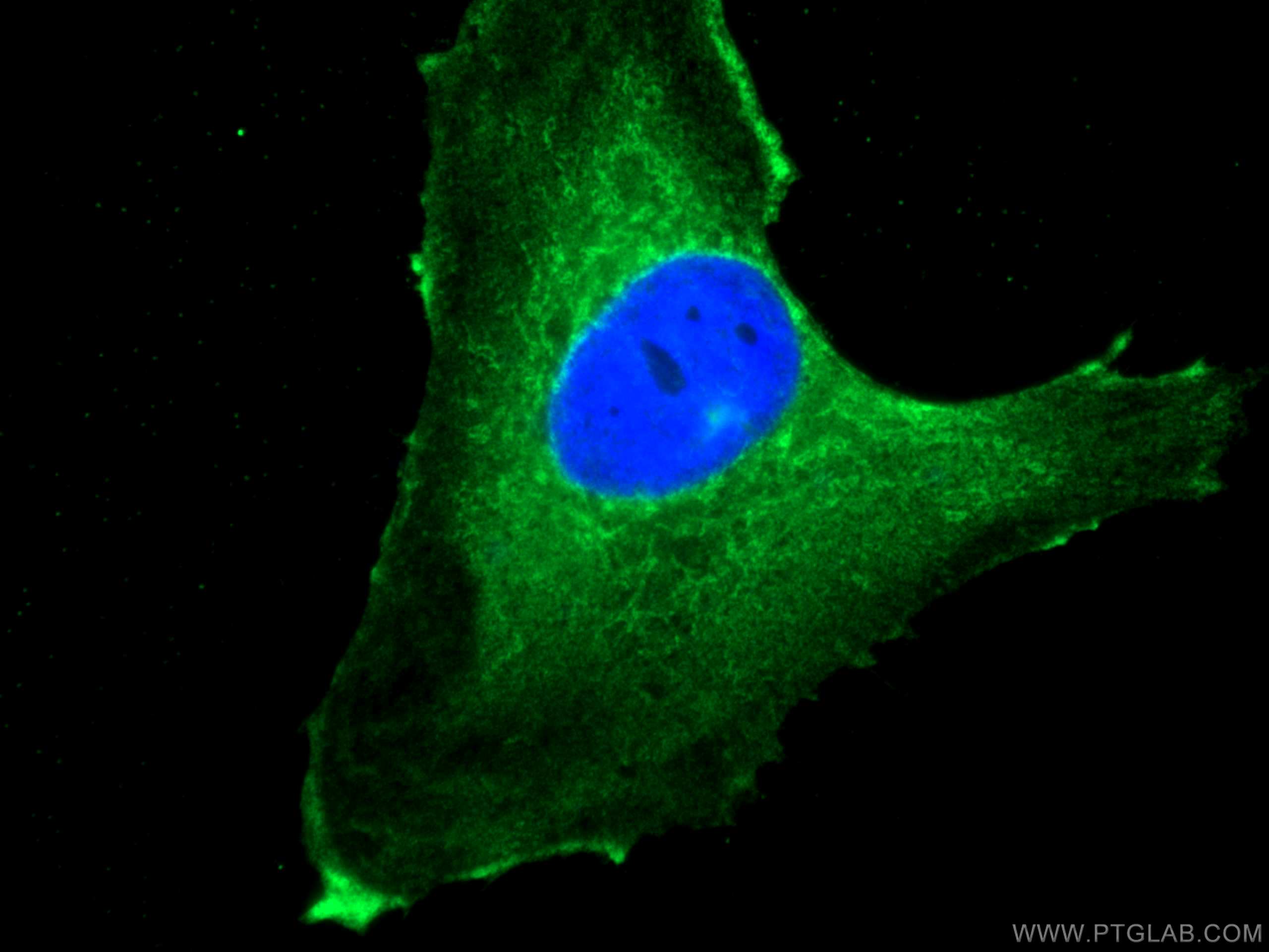 Immunofluorescence (IF) / fluorescent staining of U-251 cells using NEU1 Monoclonal antibody (67032-1-Ig)