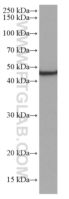 Western Blot (WB) analysis of rat pancreas tissue using NEU1 Monoclonal antibody (67032-1-Ig)