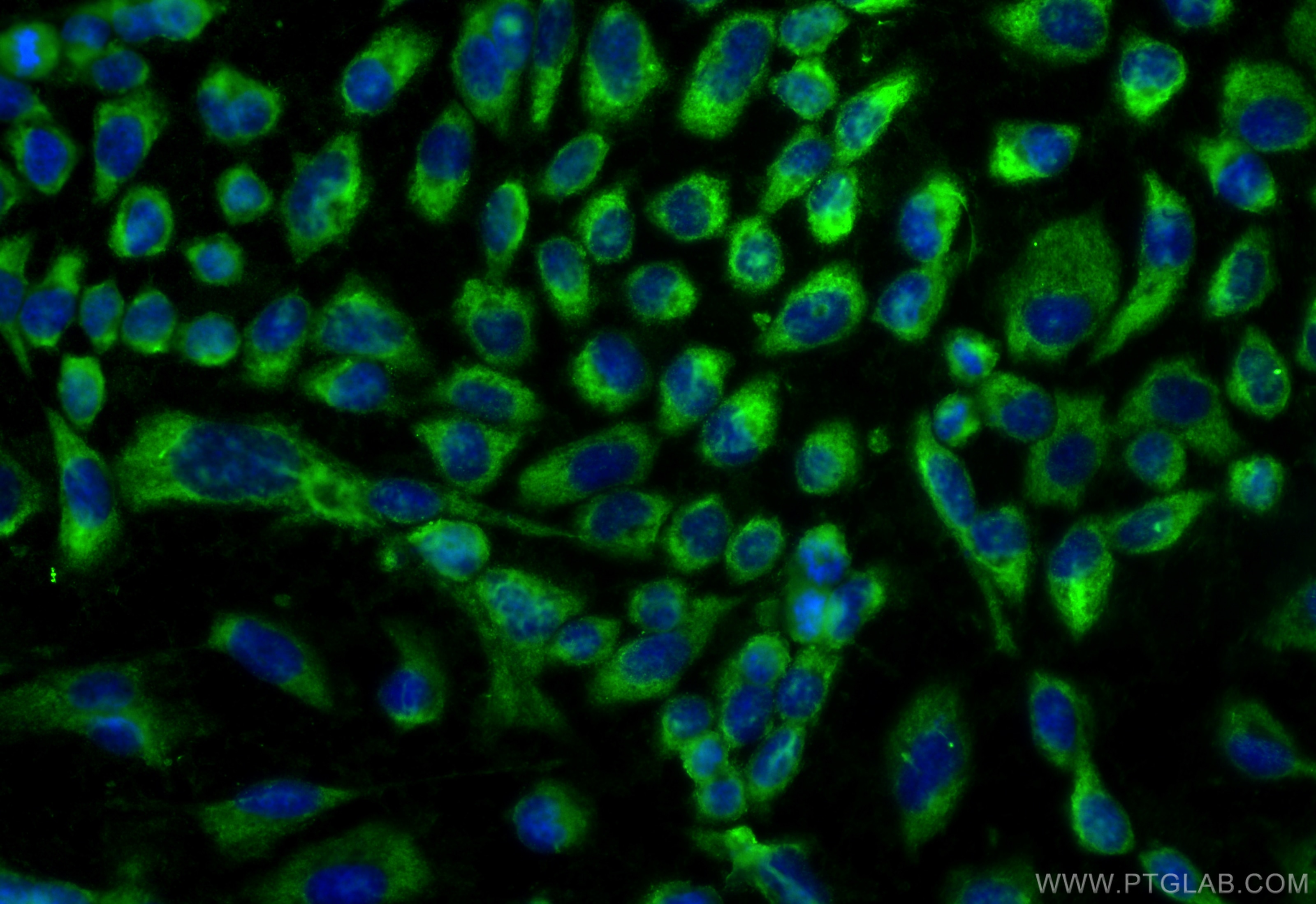 Immunofluorescence (IF) / fluorescent staining of U-251 cells using CoraLite® Plus 488-conjugated NEU1 Monoclonal anti (CL488-67032)