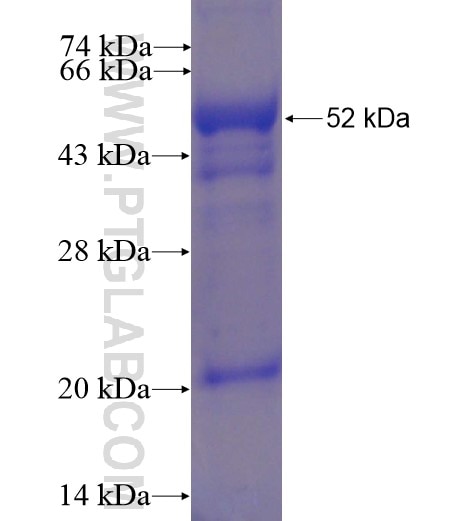 NEU1 fusion protein Ag13542 SDS-PAGE