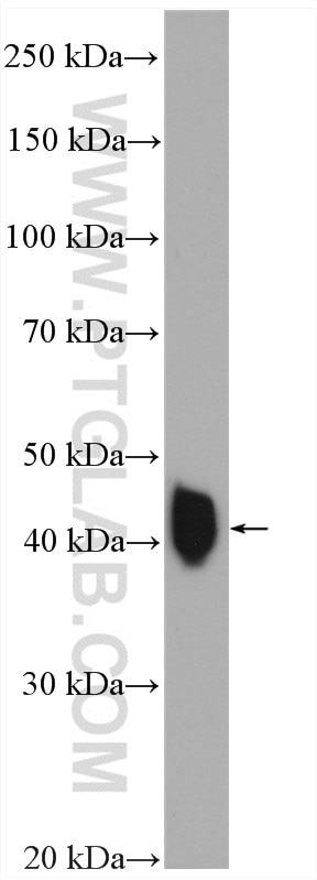 Western Blot (WB) analysis of mouse skeletal muscle tissue using NEU2 Polyclonal antibody (24523-1-AP)