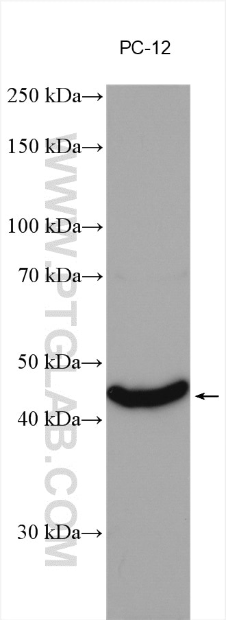 Western Blot (WB) analysis of various lysates using NEU2 Polyclonal antibody (24523-1-AP)