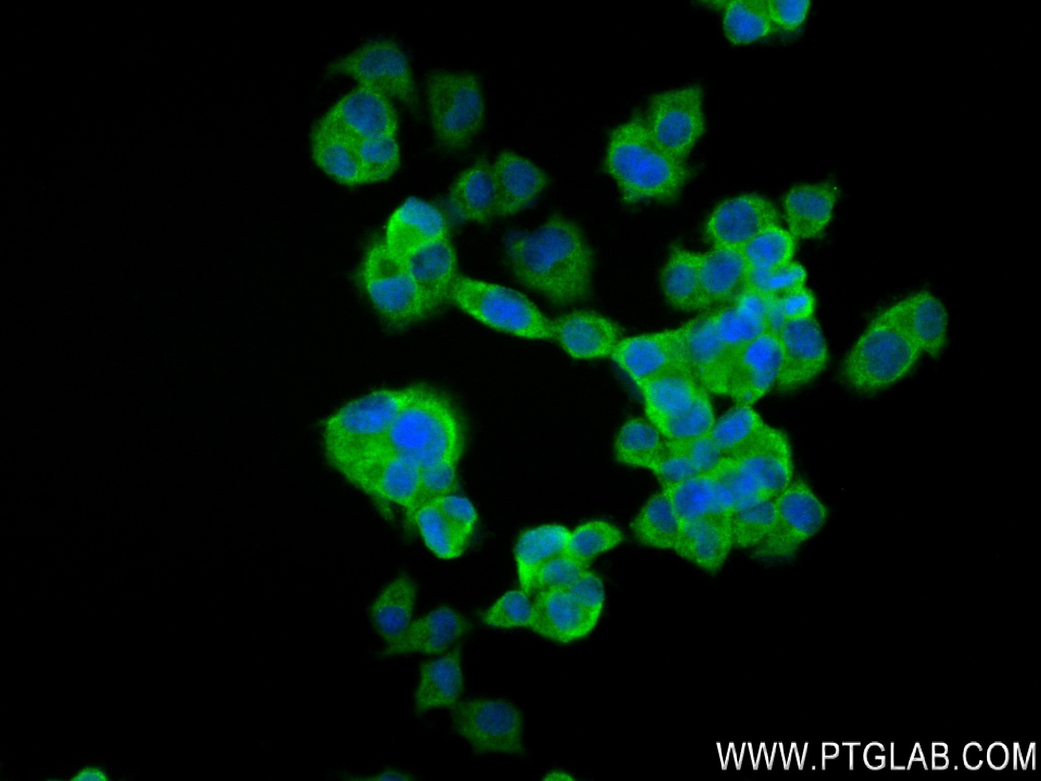 Immunofluorescence (IF) / fluorescent staining of PC-12 cells using NEU2 Recombinant antibody (83934-2-RR)