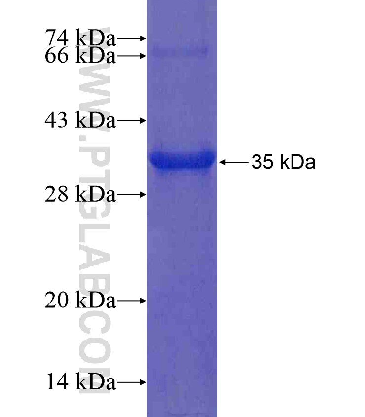 NEU2 fusion protein Ag17386 SDS-PAGE