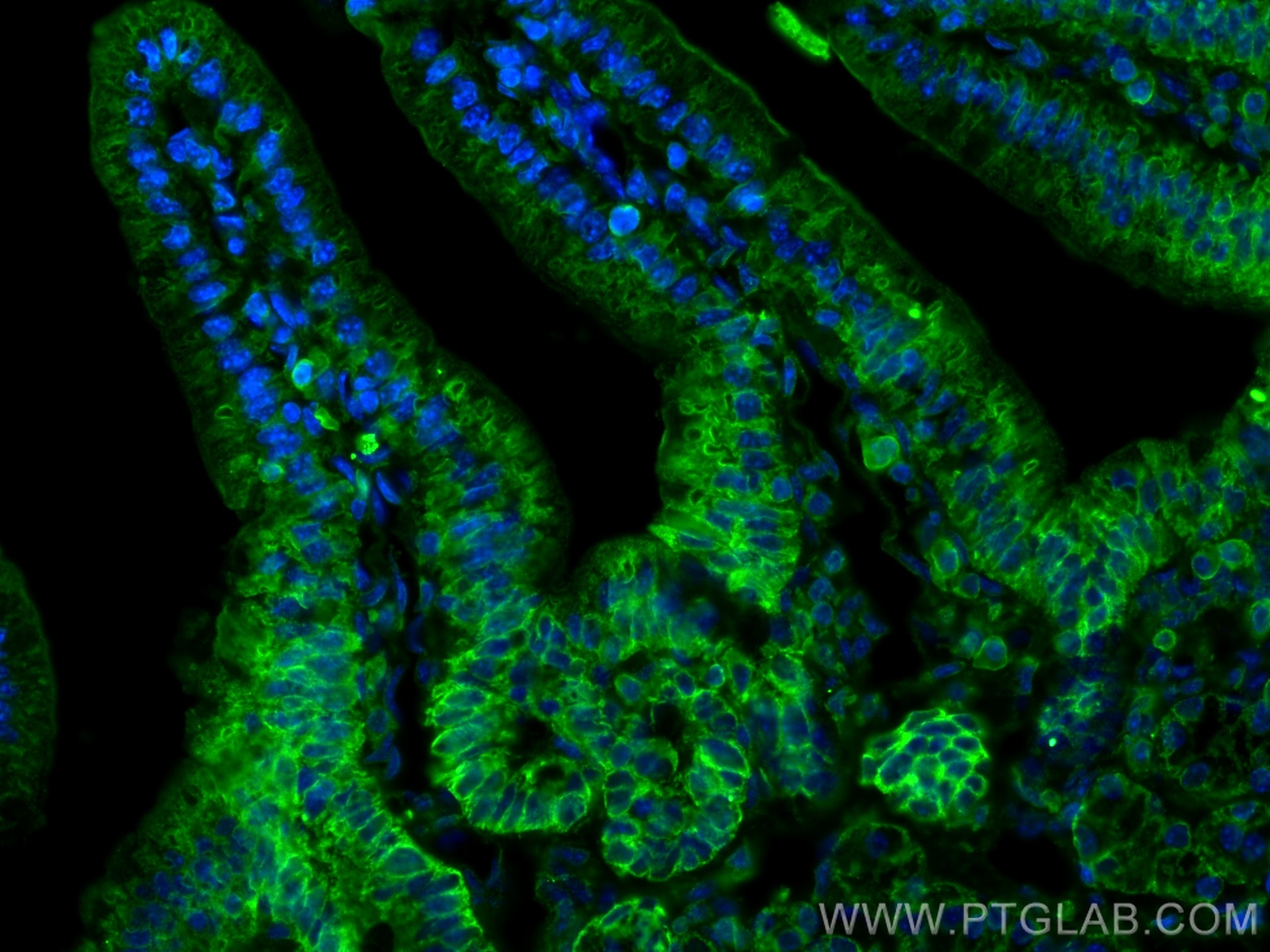Immunofluorescence (IF) / fluorescent staining of mouse small intestine tissue using NEU3 Polyclonal antibody (27879-1-AP)