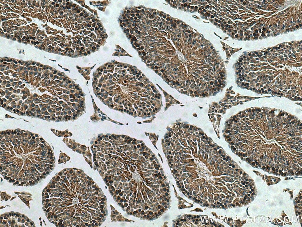 Immunohistochemistry (IHC) staining of mouse testis tissue using NEU3 Polyclonal antibody (27879-1-AP)