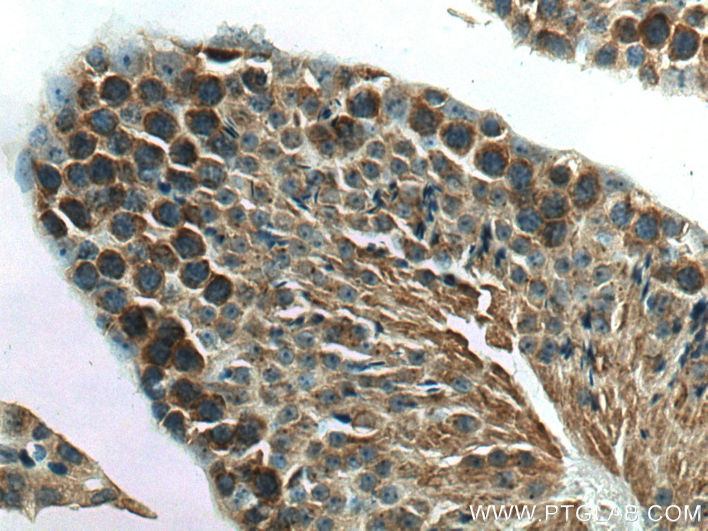 Immunohistochemistry (IHC) staining of mouse testis tissue using NEU3 Polyclonal antibody (27879-1-AP)