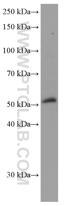 Western Blot (WB) analysis of PC-3 cells using NEU3 Monoclonal antibody (67098-1-Ig)