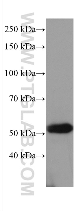 Western Blot (WB) analysis of K-562 cells using NEU3 Monoclonal antibody (67098-1-Ig)