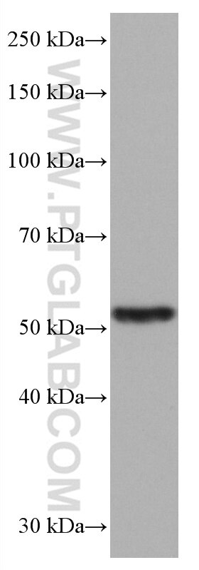 Western Blot (WB) analysis of K-562 cells using NEU3 Monoclonal antibody (67098-1-Ig)