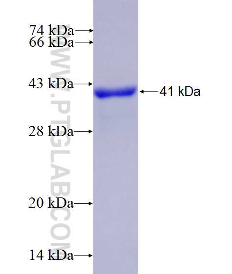 NEU3 fusion protein Ag27259 SDS-PAGE