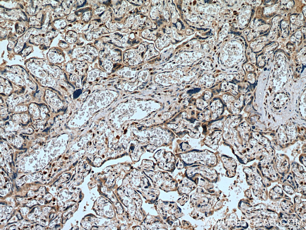 Immunohistochemistry (IHC) staining of human placenta tissue using NEU4 Polyclonal antibody (12995-1-AP)