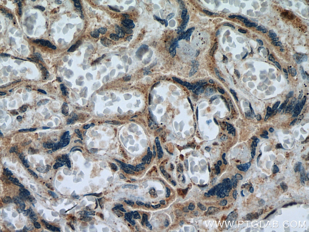 Immunohistochemistry (IHC) staining of human placenta tissue using NEU4 Polyclonal antibody (12995-1-AP)