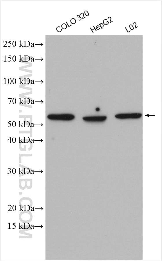 Western Blot (WB) analysis of various lysates using NEU4 Polyclonal antibody (12995-1-AP)