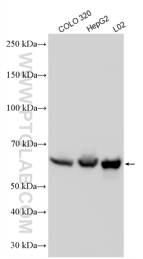 Western Blot (WB) analysis of various lysates using NEU4 Polyclonal antibody (12995-1-AP)