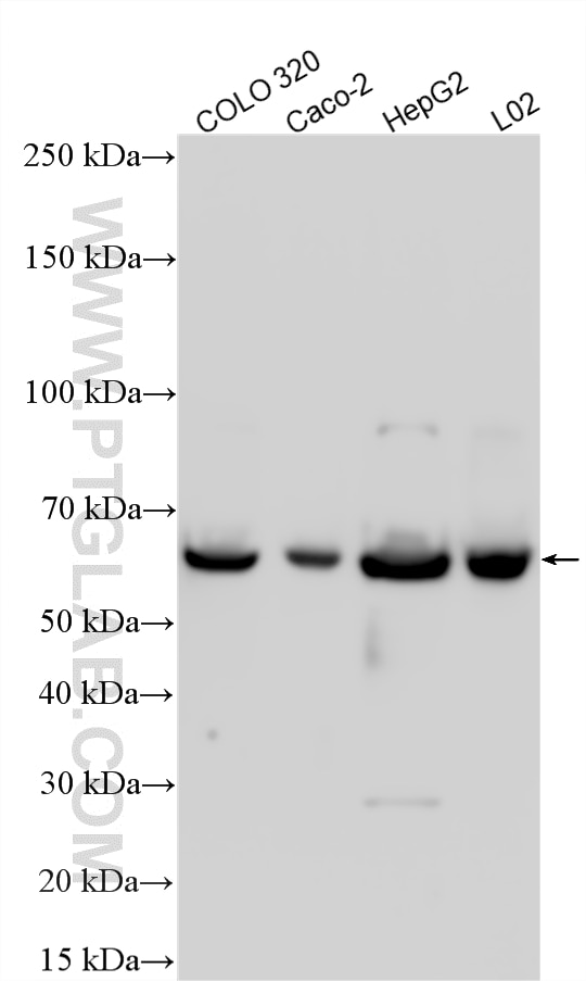 Western Blot (WB) analysis of various lysates using NEU4 Polyclonal antibody (12995-1-AP)