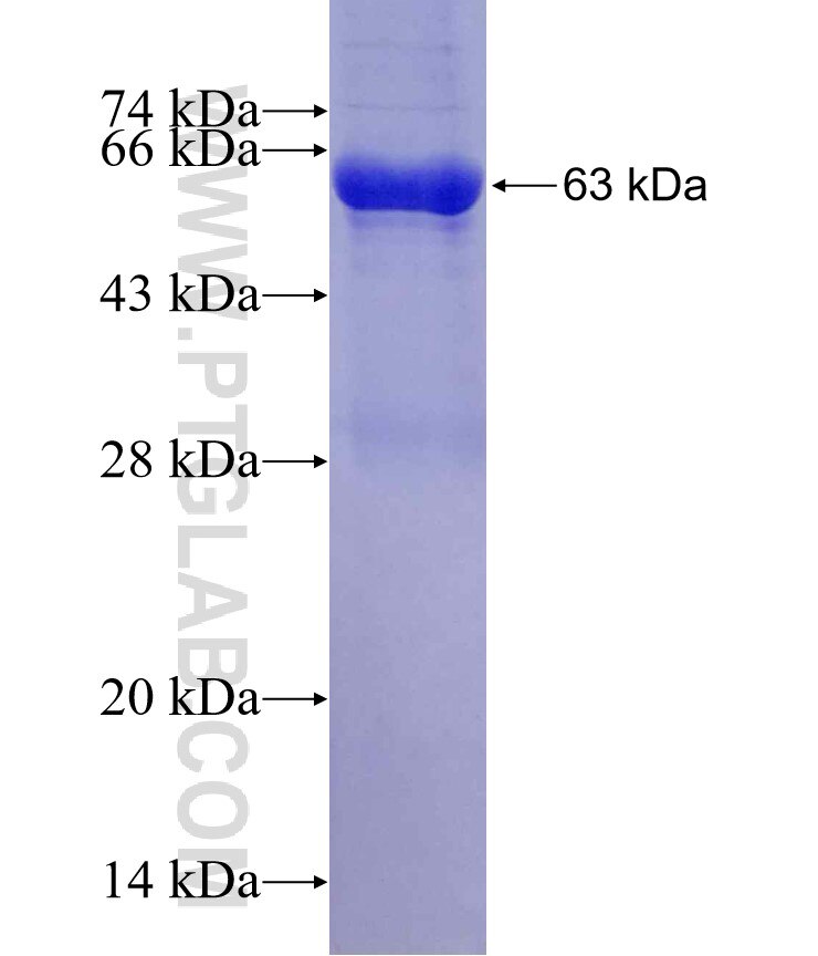 NEU4 fusion protein Ag3657 SDS-PAGE