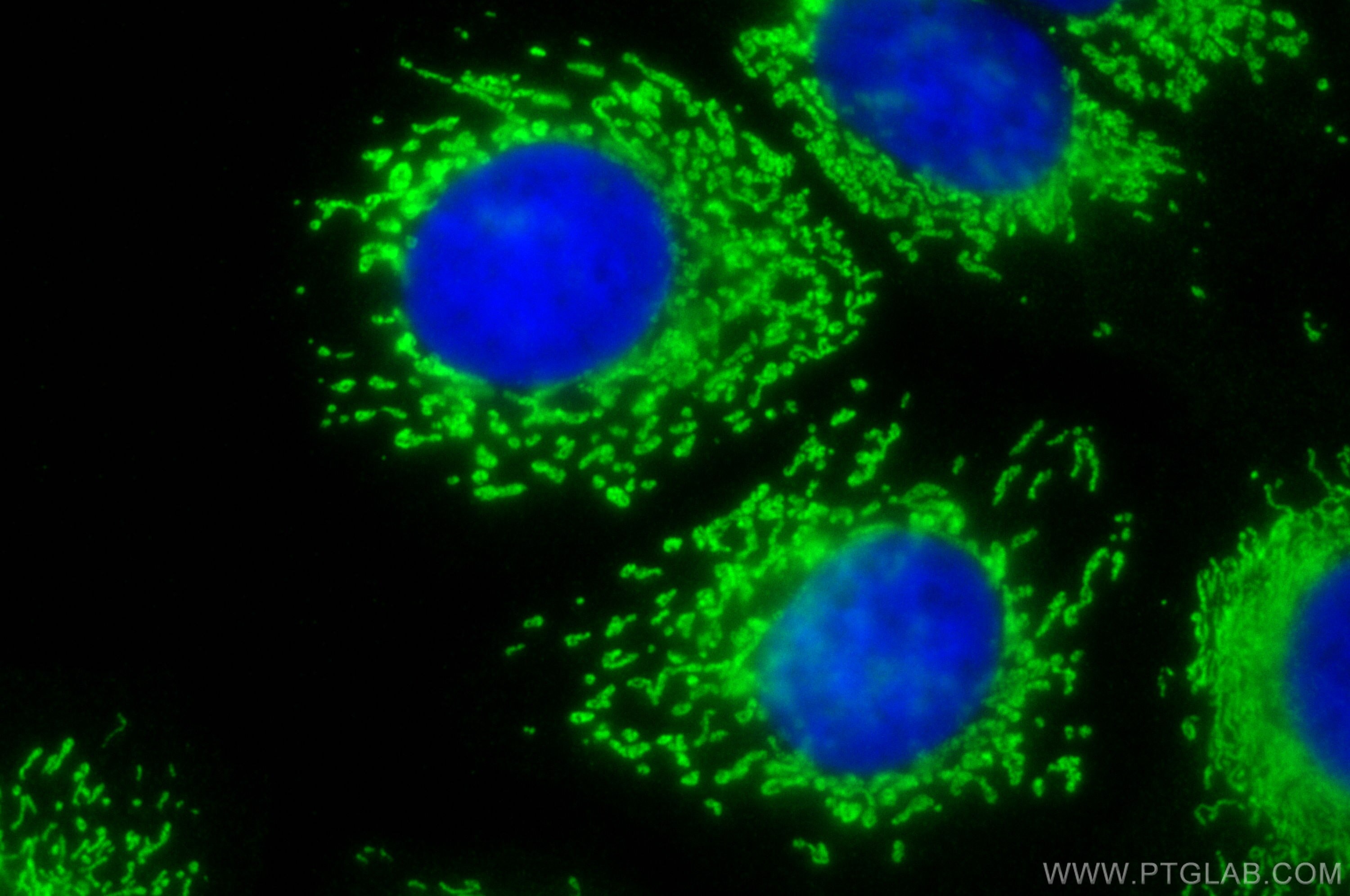 Immunofluorescence (IF) / fluorescent staining of MCF-7 cells using NEURL Polyclonal antibody (18898-1-AP)