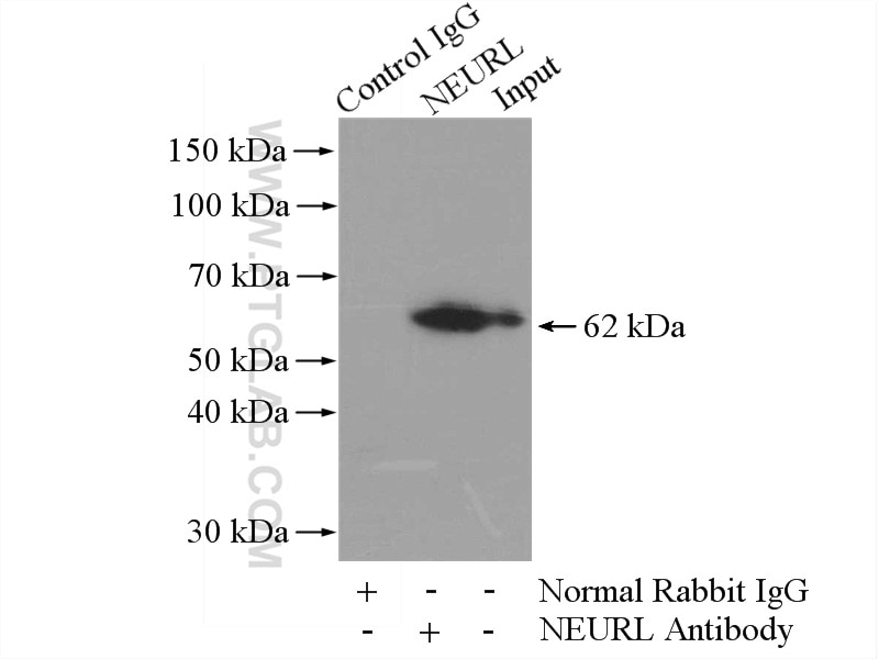 IP experiment of mouse brain using 18898-1-AP