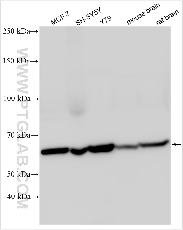 Western Blot (WB) analysis of various lysates using NEURL Polyclonal antibody (18898-1-AP)