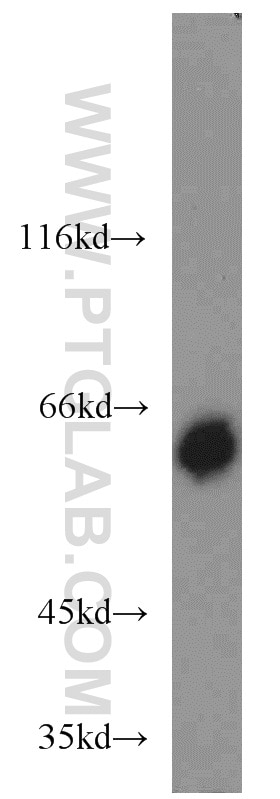 Western Blot (WB) analysis of MCF-7 cells using NEURL Polyclonal antibody (18898-1-AP)