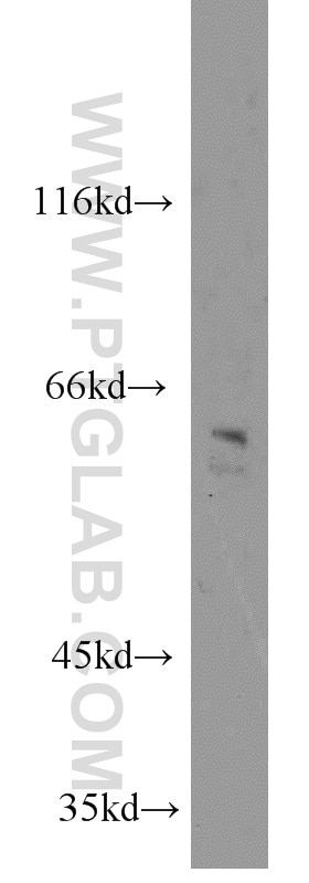 Western Blot (WB) analysis of Y79 cells using NEURL Polyclonal antibody (18898-1-AP)