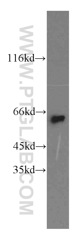 Western Blot (WB) analysis of mouse brain tissue using NEURL Polyclonal antibody (18898-1-AP)