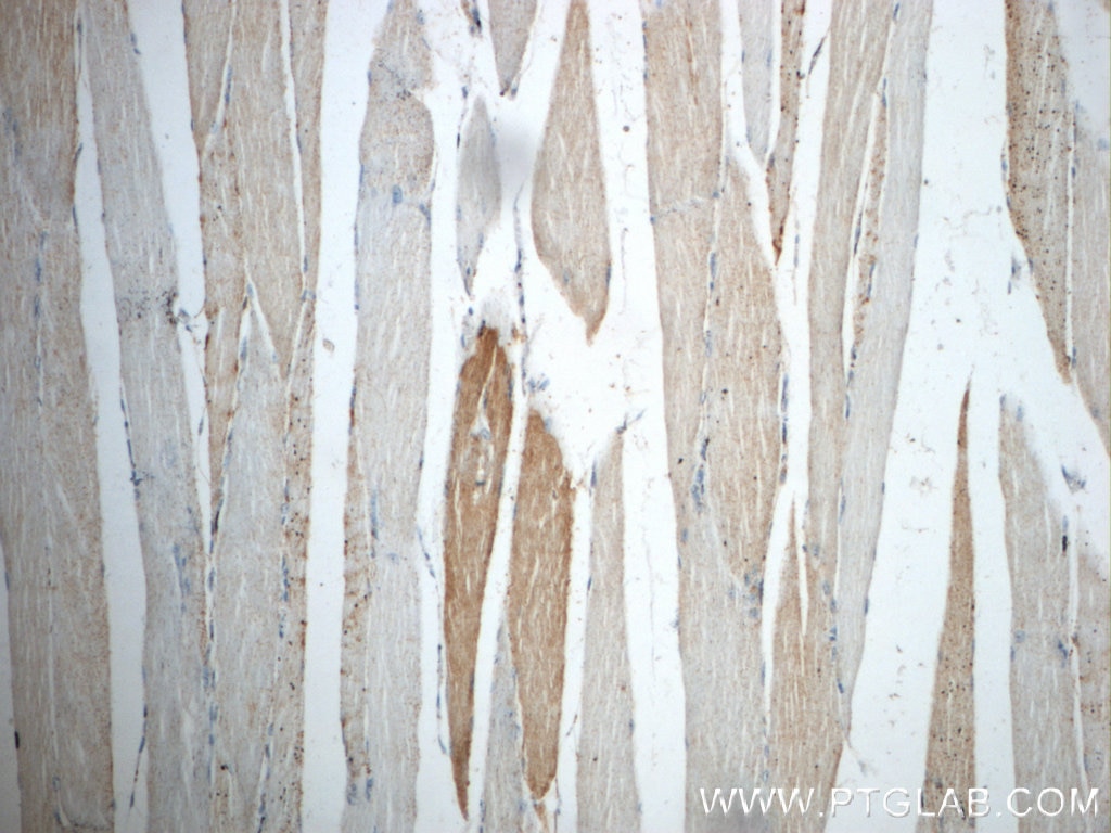 Immunohistochemistry (IHC) staining of human skeletal muscle tissue using NEURL2 Polyclonal antibody (21263-1-AP)