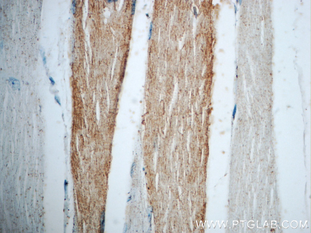 IHC staining of human skeletal muscle using 21263-1-AP