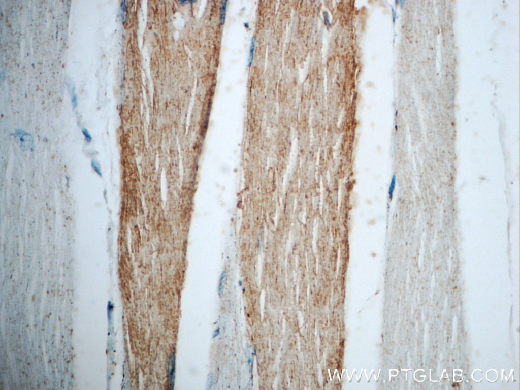 Immunohistochemistry (IHC) staining of human skeletal muscle tissue using NEURL2 Polyclonal antibody (21263-1-AP)