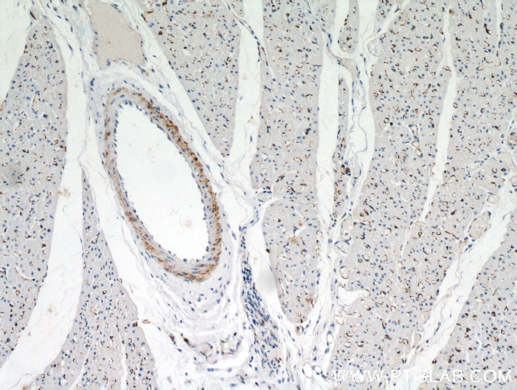 IHC staining of human heart using 21263-1-AP