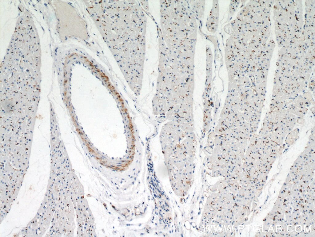 Immunohistochemistry (IHC) staining of human heart tissue using NEURL2 Polyclonal antibody (21263-1-AP)