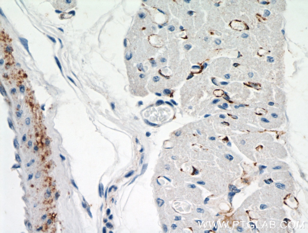 Immunohistochemistry (IHC) staining of human heart tissue using NEURL2 Polyclonal antibody (21263-1-AP)