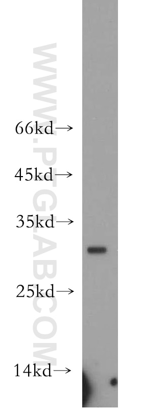 Western Blot (WB) analysis of HL-60 cells using NEURL2 Polyclonal antibody (21263-1-AP)