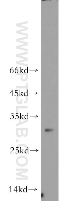 Western Blot (WB) analysis of HL-60 cells using NEURL2 Polyclonal antibody (21263-1-AP)