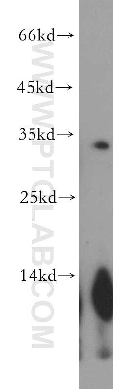 WB analysis of human heart using 21263-1-AP