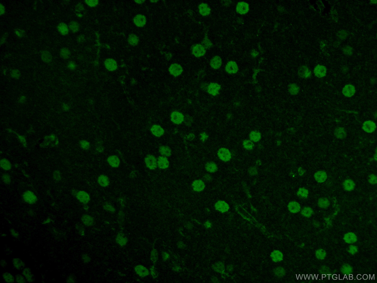 Immunofluorescence (IF) / fluorescent staining of mouse brain tissue using NEUROD1 Polyclonal antibody (12081-1-AP)