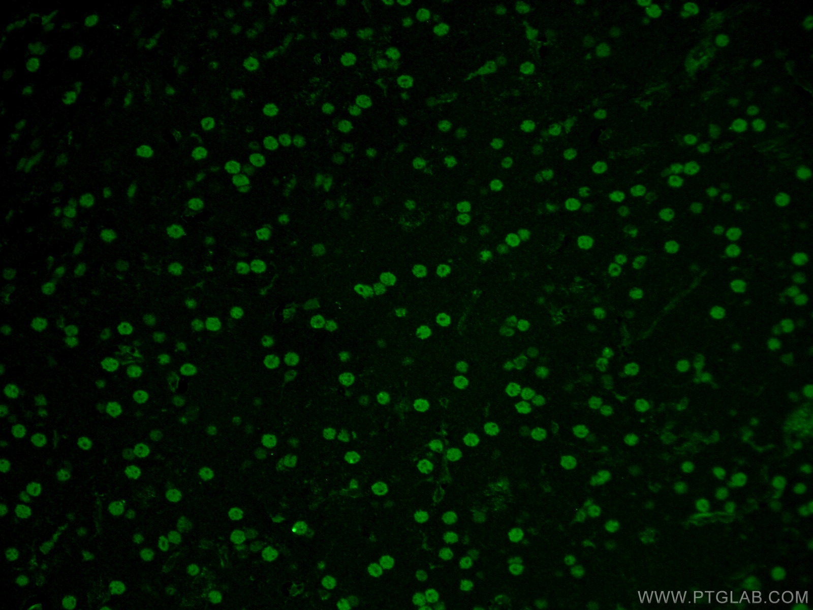 Immunofluorescence (IF) / fluorescent staining of mouse brain tissue using NEUROD1 Polyclonal antibody (12081-1-AP)