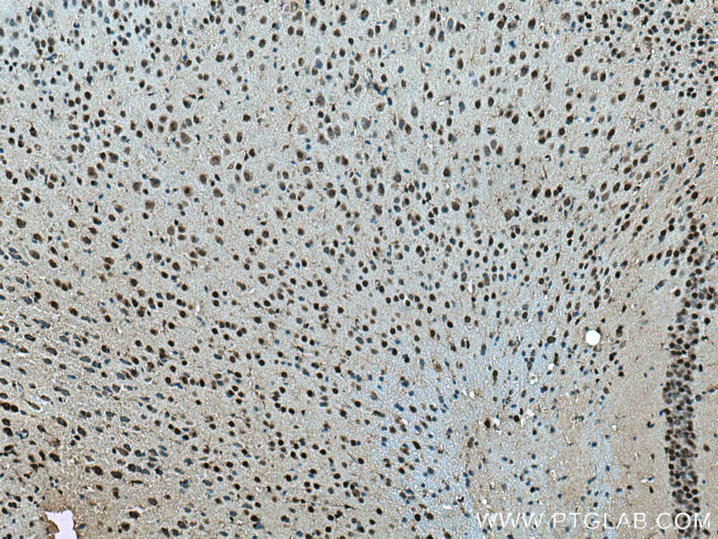 IHC staining of mouse brain using 12081-1-AP