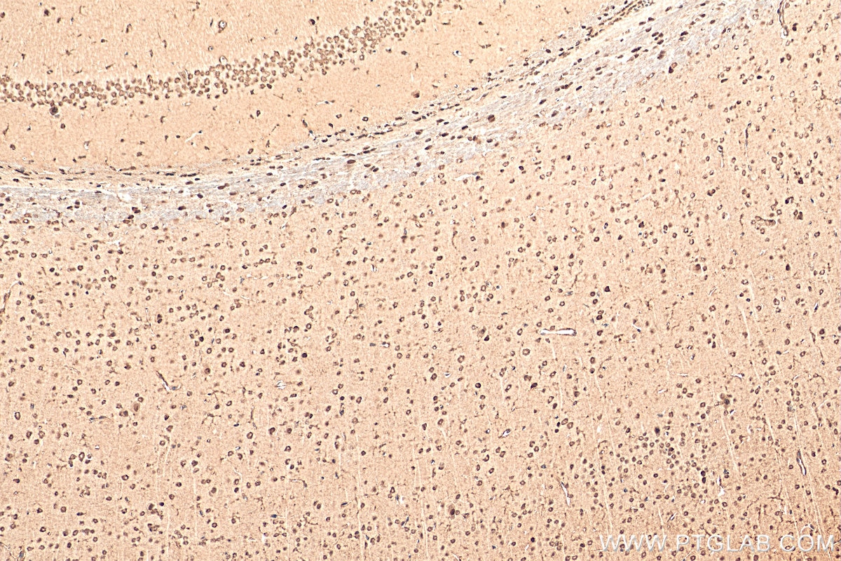 Immunohistochemistry (IHC) staining of mouse brain tissue using NEUROD1 Polyclonal antibody (12081-1-AP)