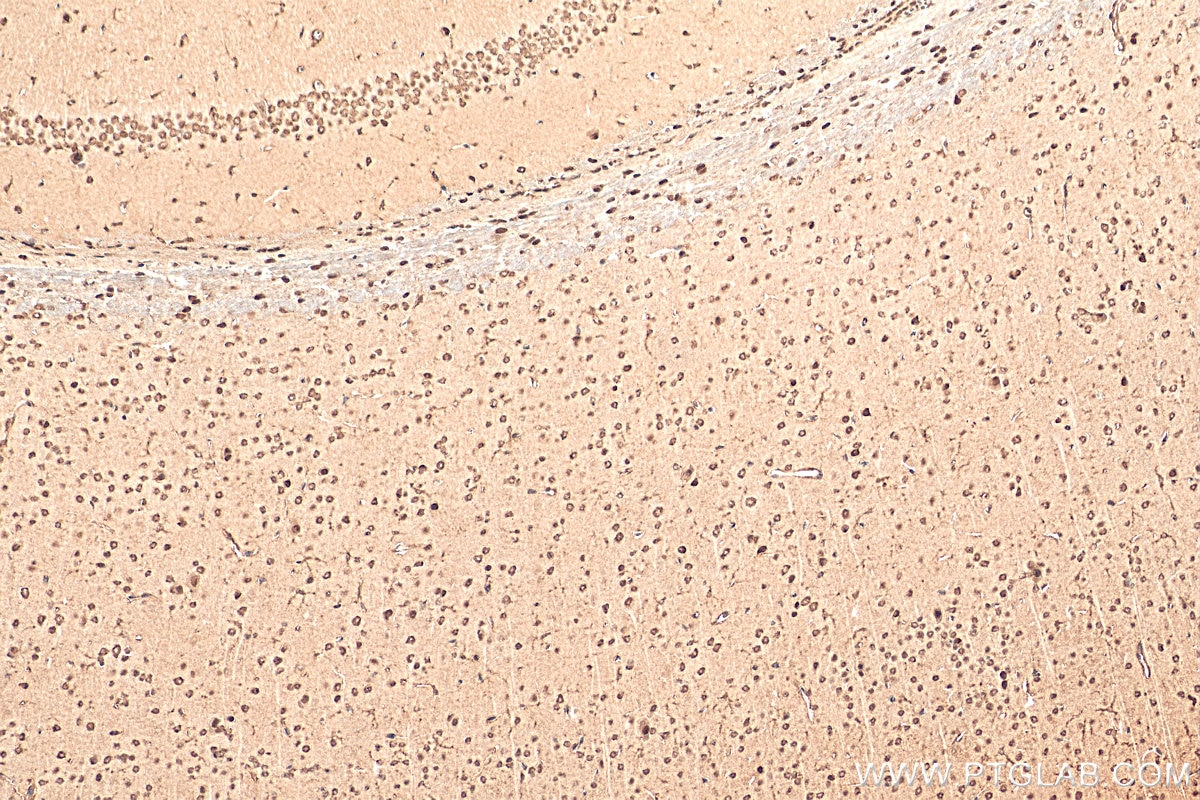 IHC staining of mouse brain using 12081-1-AP