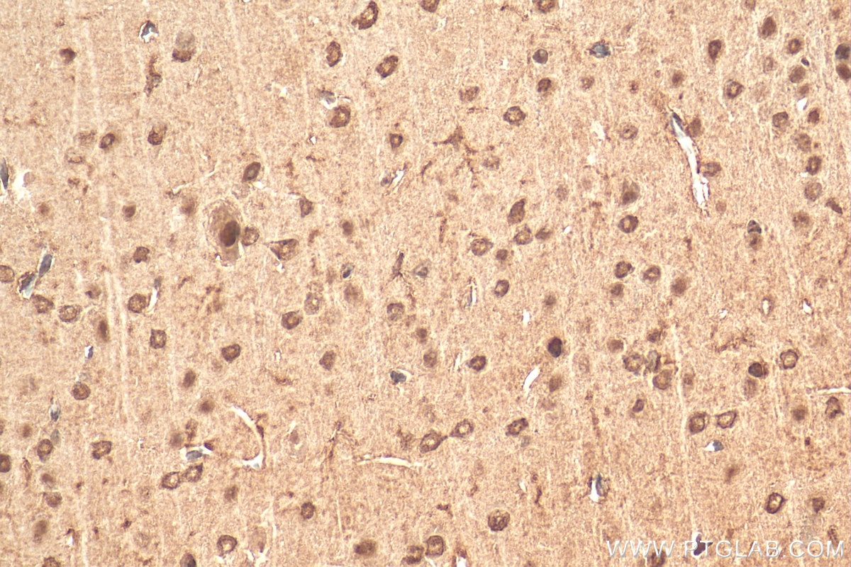 Immunohistochemistry (IHC) staining of mouse brain tissue using NEUROD1 Polyclonal antibody (12081-1-AP)